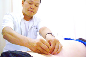 鍼灸施術に自信があります